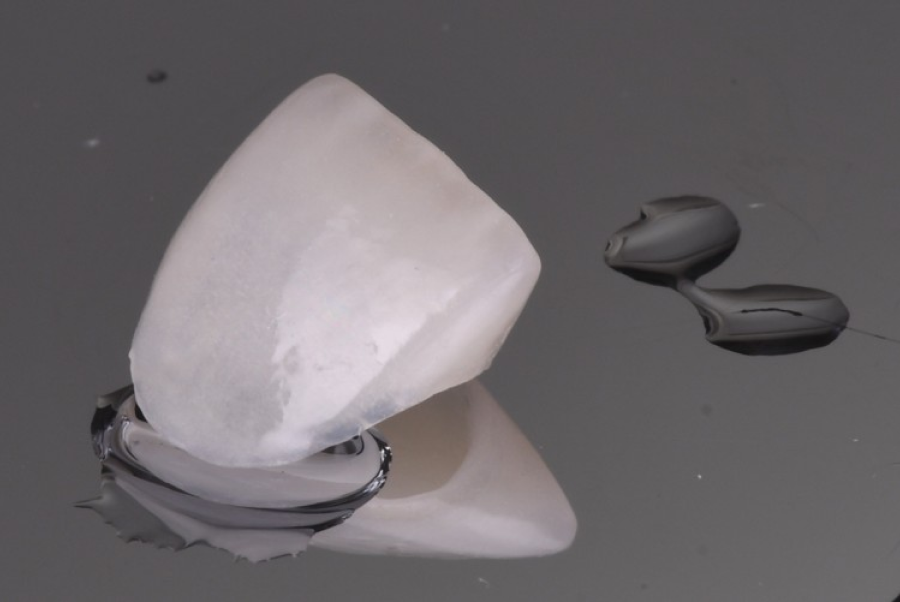 blanchiment dentaire strasbourg Traitement des fractures Dentiste Orangerie, Strasbourg | Esthétique & Implant