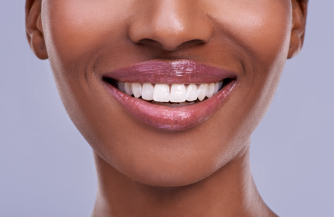 cabinet aesthetic dentistry blanchiment Blanchiment dentaire : un sourire éclatant en toute sécurité Dentiste Orangerie, Strasbourg | Esthétique & Implant