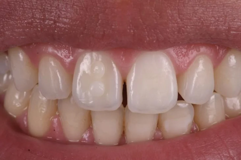 cabinet aesthetic dentistry implants cabinet aesthetic dentistry implants Concept de gradient thérapeutique Dentiste Orangerie, Strasbourg | Esthétique & Implant