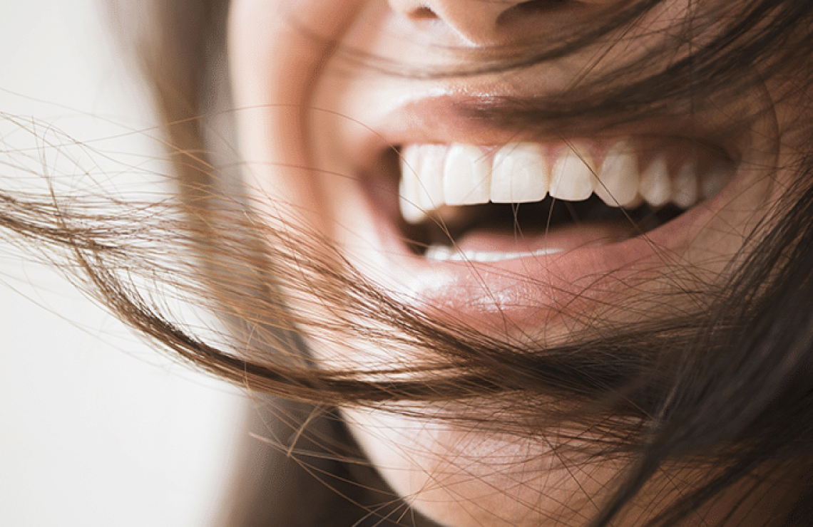 cabinet aesthetic dentistry orthodontie Composite stratifié : la précision esthétique au naturel Dentiste Orangerie, Strasbourg | Esthétique & Implant