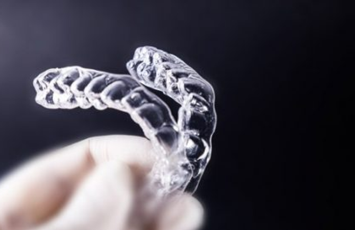 cabinet aesthetic dentistry protheses Orthodontie : rééquilibrer et aligner votre sourire Dentiste Orangerie, Strasbourg | Esthétique & Implant