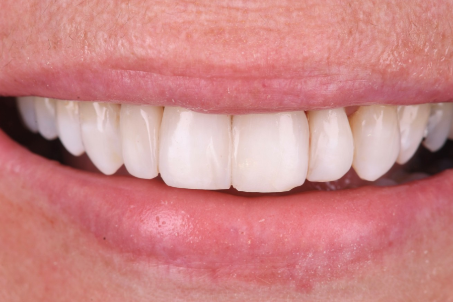 centre dentaire strasbourg centre dentaire strasbourg Traitement des gencives inflammées et parodontite Dentiste Orangerie, Strasbourg | Esthétique & Implant