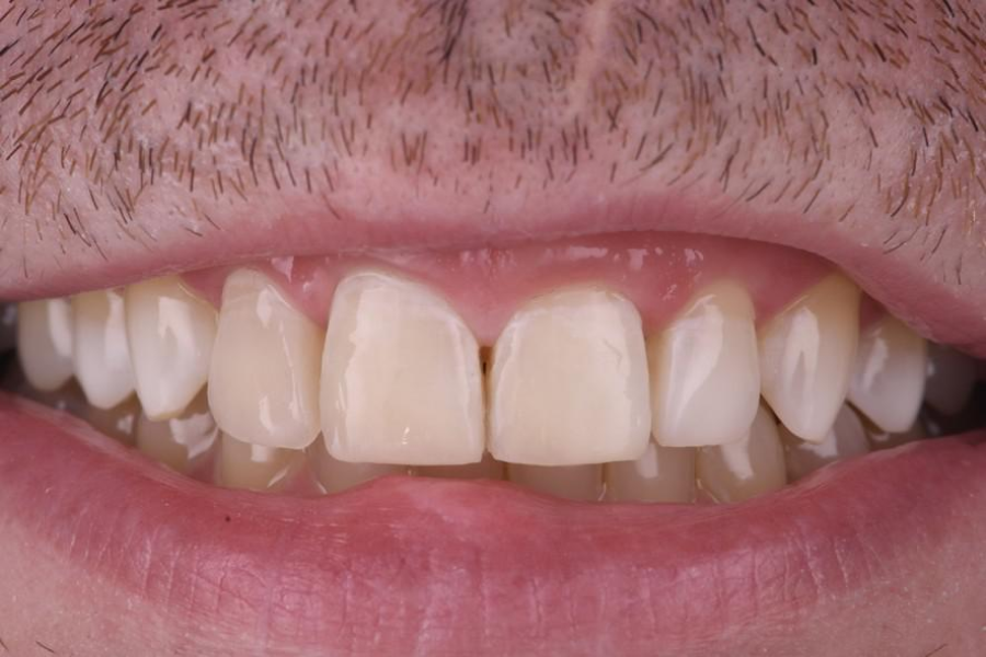 chirurgie dentaire strasbourg chirurgie dentaire strasbourg Traitement des fractures Dentiste Orangerie, Strasbourg | Esthétique & Implant