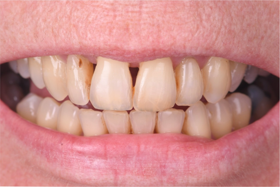 clinique dentaire strasbourg clinique dentaire strasbourg Traitement des gencives inflammées et parodontite Dentiste Orangerie, Strasbourg | Esthétique & Implant