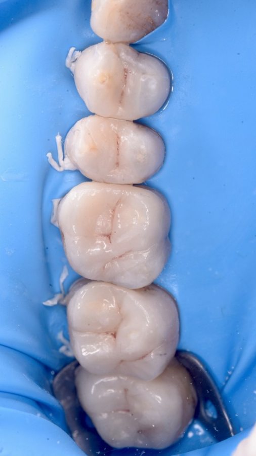 dentiste strasbourg orangerie dentiste strasbourg orangerie Remplacement d’anciens soins Dentiste Orangerie, Strasbourg | Esthétique & Implant
