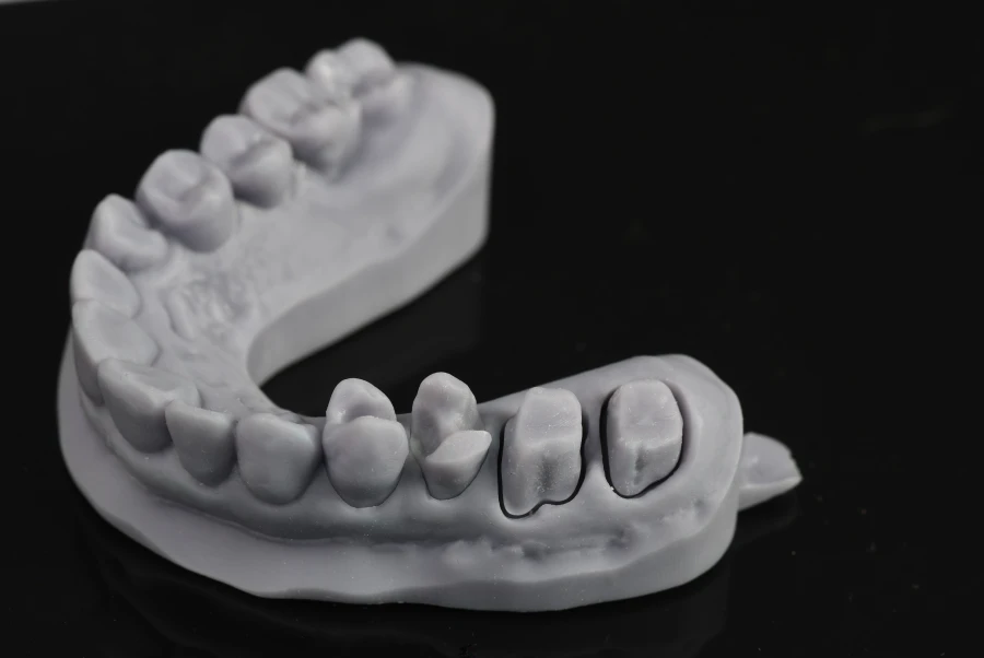 facettes dentaires sourire parfait Couronnes dentaires : allier esthétique et durabilité Dentiste Orangerie, Strasbourg | Esthétique & Implant