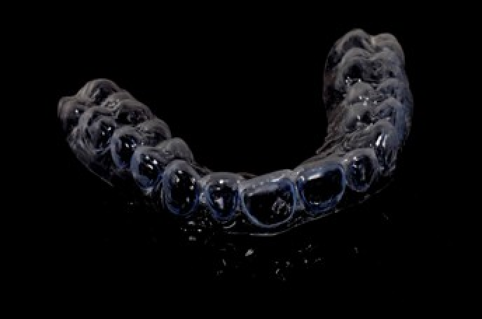 implant unique strasbourg Blanchiment dentaire : un sourire éclatant en toute sécurité Dentiste Orangerie, Strasbourg | Esthétique & Implant