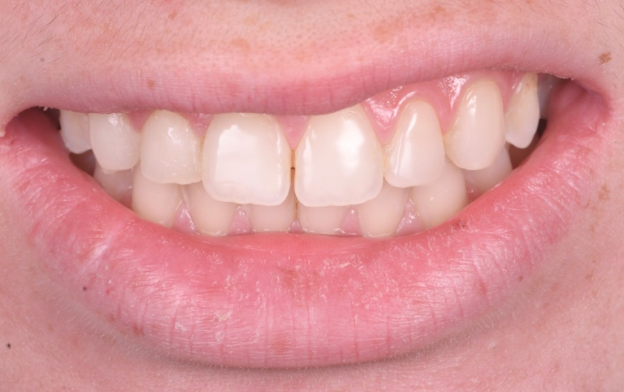 orthodontie strasbourg orangerie orthodontie strasbourg orangerie Gestion des caries : préserver vos dents avant tout Dentiste Orangerie, Strasbourg | Esthétique & Implant