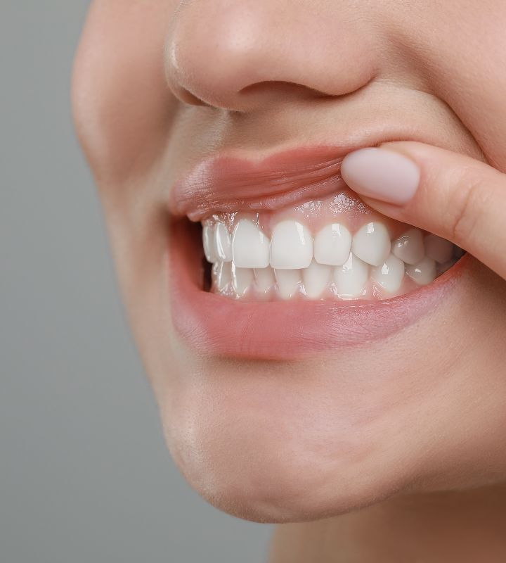 Dentiste Orangerie, Strasbourg | Esthétique & Implant soins gingivaux strasbourg Concept de gradient thérapeutique Dentisterie esthétique : sublimez votre sourire