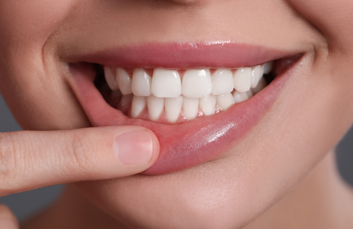 soins gencives professionnels Traitement des gencives inflammées et parodontite Dentiste Orangerie, Strasbourg | Esthétique & Implant
