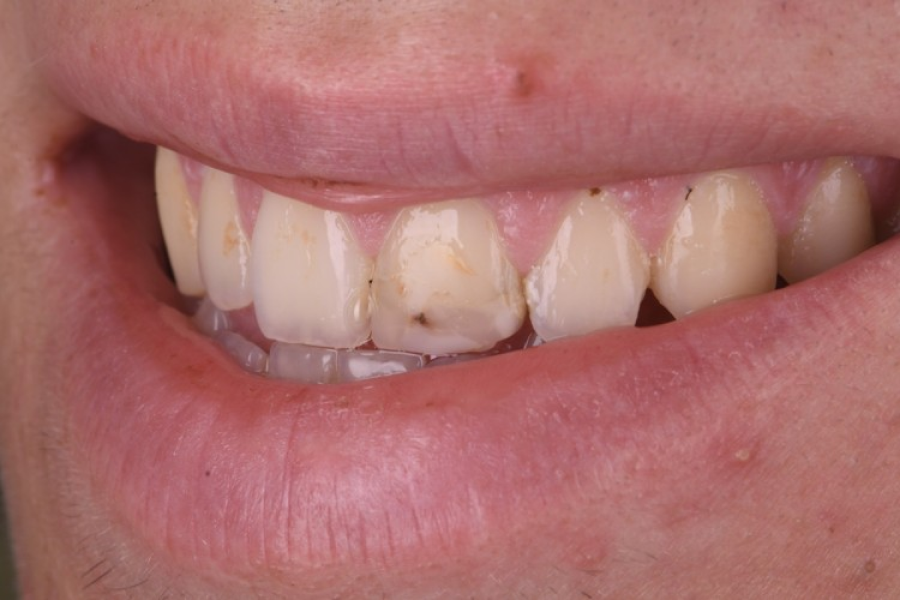 soins gencives strasbourg soins gencives strasbourg Traitement des fractures Dentiste Orangerie, Strasbourg | Esthétique & Implant