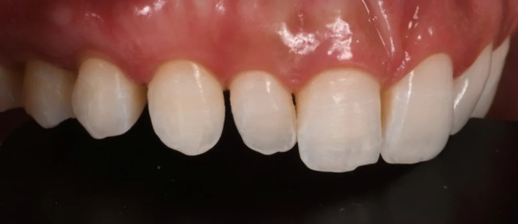 soins gingivaux strasbourg soins gingivaux strasbourg Concept de gradient thérapeutique Dentiste Orangerie, Strasbourg | Esthétique & Implant