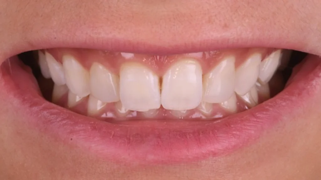 soins parodontaux strasbourg soins parodontaux strasbourg Concept de gradient thérapeutique Dentiste Orangerie, Strasbourg | Esthétique & Implant