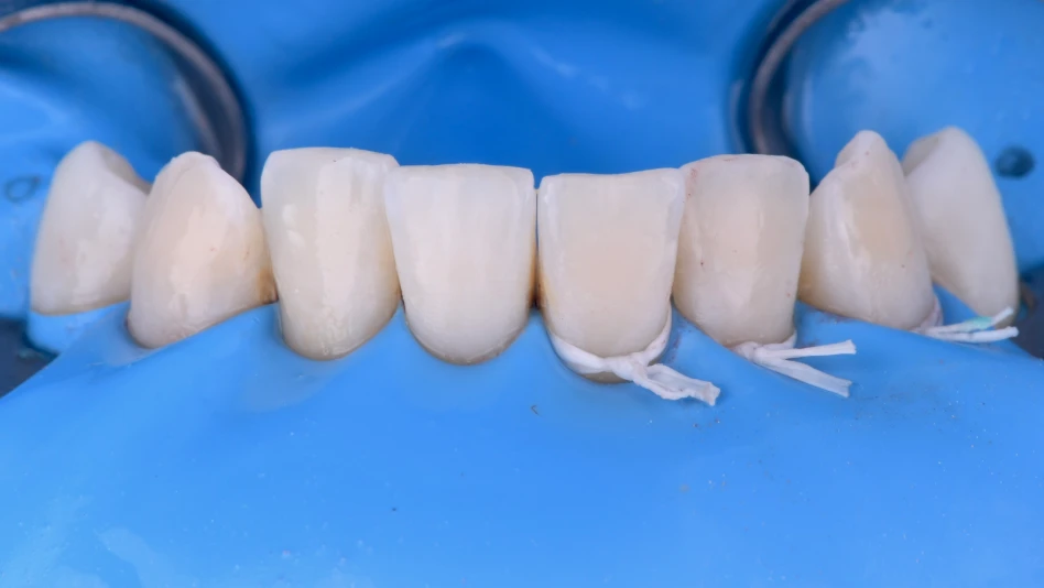 taches dentaires machoire bas dentiste strasbourg 1 Traitement des tâches dentaires : un sourire magnifié Dentiste Orangerie, Strasbourg | Esthétique & Implant