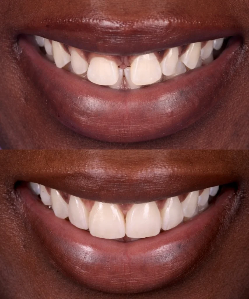 soins dentaires strasbourg orangerie soins dentaires strasbourg orangerie Des traitements esthétiques pour transformer votre sourire Dentiste Orangerie, Strasbourg | Esthétique & Implant