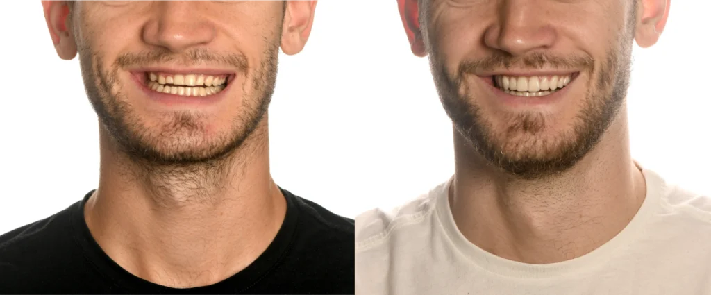 transformation sourire strasbourg transformation sourire strasbourg Transformation numérique du sourire Dentiste Orangerie, Strasbourg | Esthétique & Implant