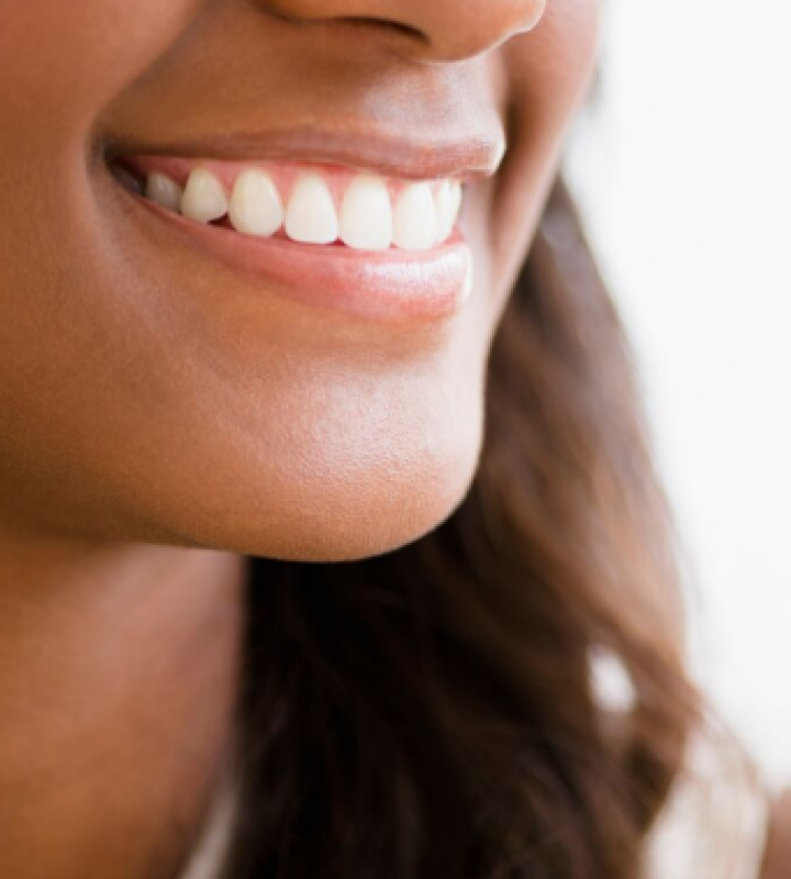 Dentiste Orangerie, Strasbourg | Esthétique & Implant taches dentaires traitement strasbourg Traitement des tâches dentaires : un sourire magnifié Dentisterie esthétique : sublimez votre sourire