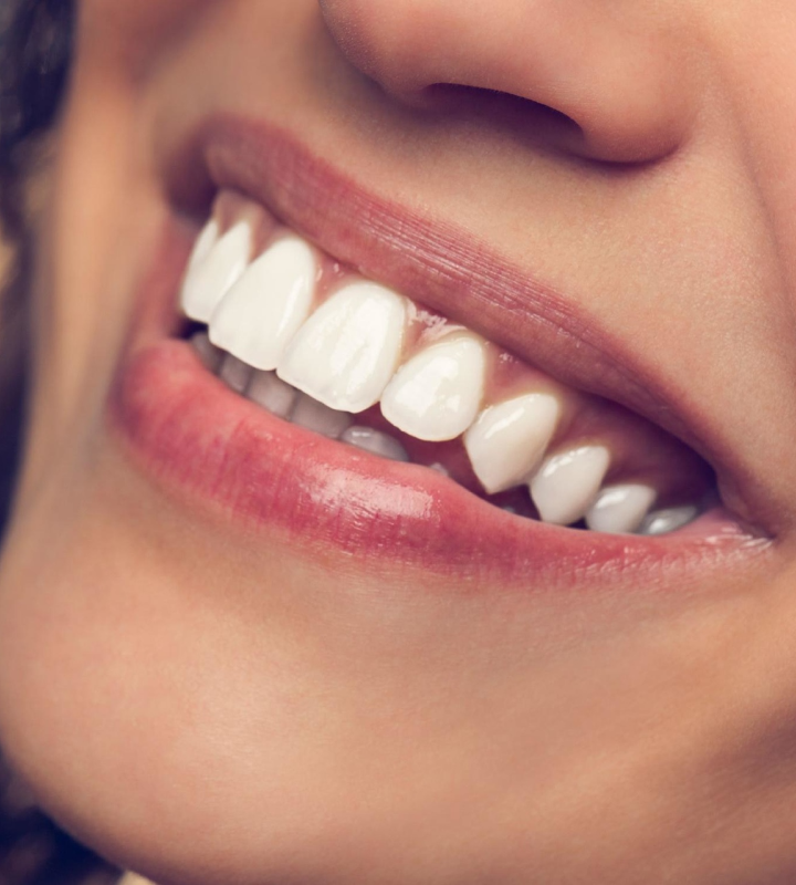 implants-dentaires-haute-qualite