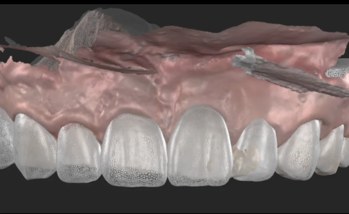 Dentiste Orangerie, Strasbourg | Esthétique & Implant taches dentaires traitement strasbourg Traitement des tâches dentaires : un sourire magnifié Dentisterie esthétique : sublimez votre sourire